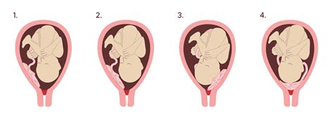 Infographic die de reis van de baby door het geboortekanaal illustreert.