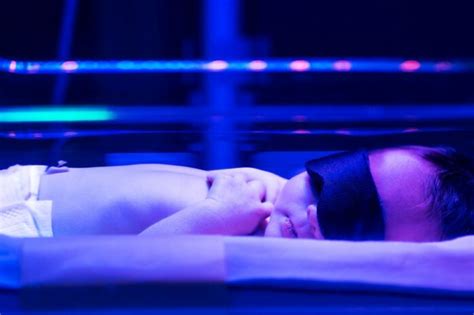 illustratie van een baby met geelzucht liggend onder een UV-lamp