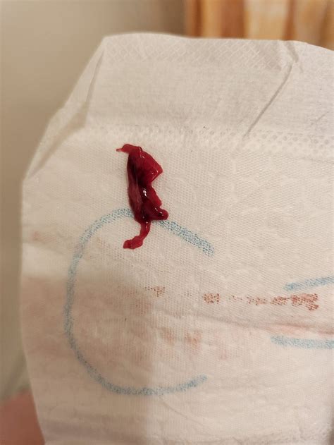 Symbolische rituelen na een miskraam