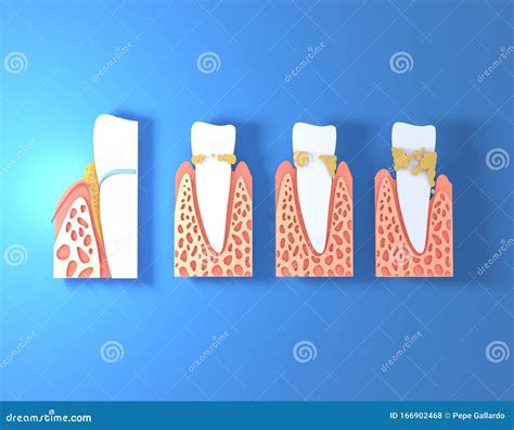 Illustratie van de verschillende fasen van het BioHCG dieet