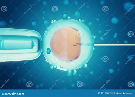 Illustratie van het proces van intra-uteriene inseminatie