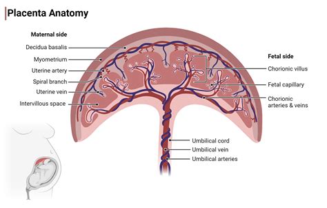 Schematische weergave van een circumvallate placenta met de omgevouwen membranen.
