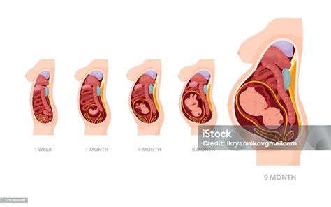 Illustratie van verschillende stadia van de bevalling