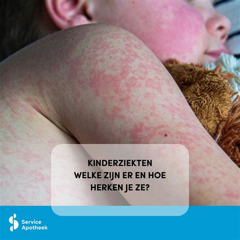 Infographic met veelvoorkomende kinderziekten behandeld op de polikliniek