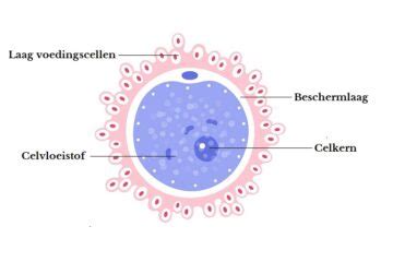 schematische weergave van de ICSI-procedure, waarbij een zaadcel in een eicel wordt geïnjecteerd