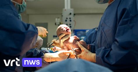 Foto van een baby in huid-op-huid contact met de moeder direct na een keizersnede