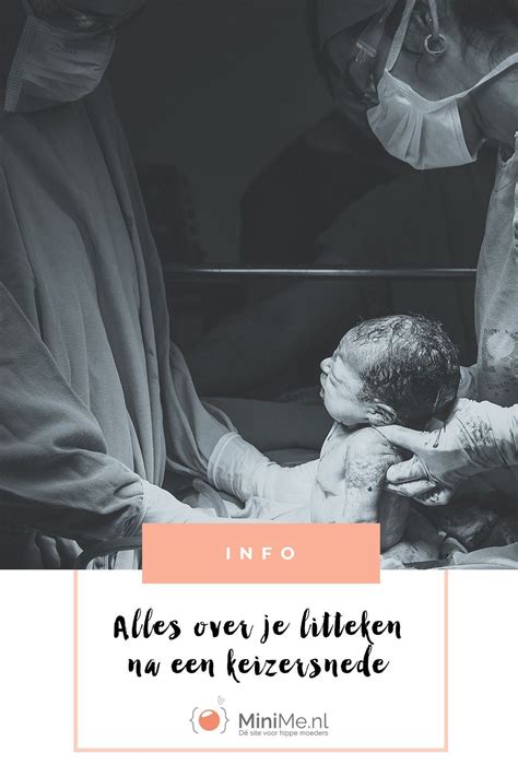 Illustratie van een litteken na keizersnede met uitleg over verzorging