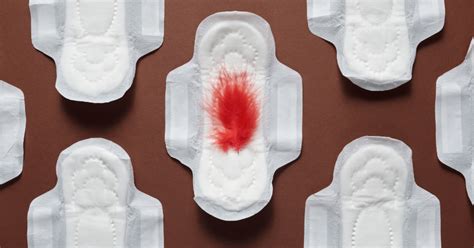 Schema dat de verschillende soorten vaginaal bloedverlies tijdens de zwangerschap en hun mogelijke oorzaken weergeeft.