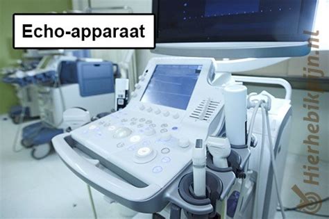 Schematische weergave van een echo-apparaat dat gebruikt wordt voor het in beeld brengen van organen.