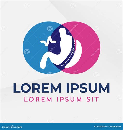 Illustratie van een laparoscopische chirurgische procedure.