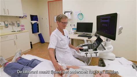 illustratie van een vaginale echoapparaat