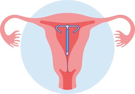 illustratie van een koperspiraal