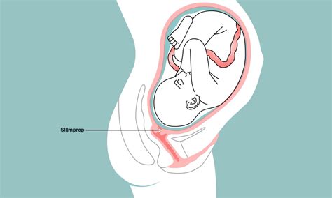 voorbeeld van slijmprop