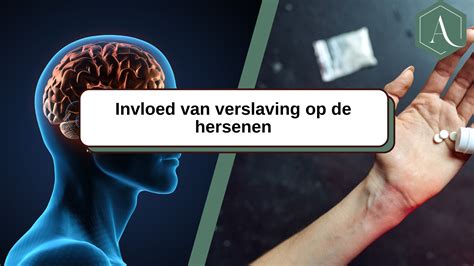 Infographic die de mogelijke oorzaken en gevolgen van hersenschade bij aangeboren hartafwijkingen weergeeft.