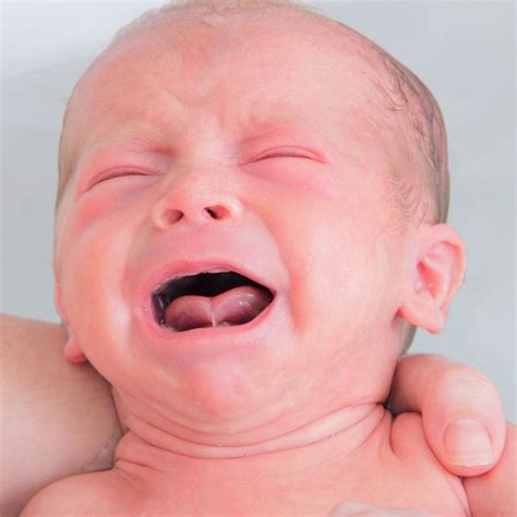 illustratie van een te korte tongriem bij een baby