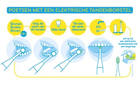 Illustratie van de juiste poetsmethode voor kinderen