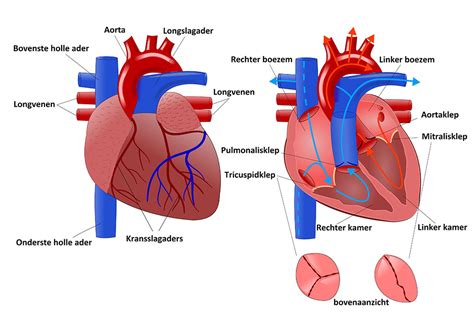 Schematische weergave van de normale positie van het hart in de borstkas versus ectopia cordis waarbij het hart buiten de borstkas ligt.