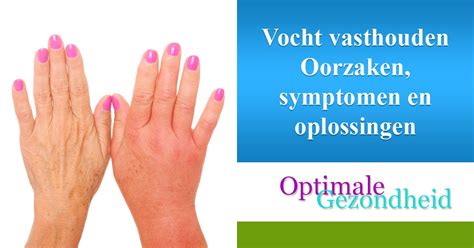 infographic met de oorzaken van vocht vasthouden tijdens de zwangerschap