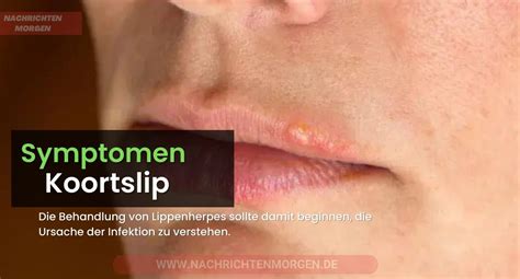 Vergelijkingstabel: Koortslip vs. Puistje