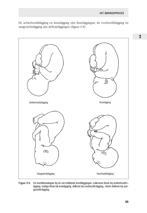 Schematische weergave van de achterhoofdsligging en de sterrenkijkerligging van een baby in het bekken.