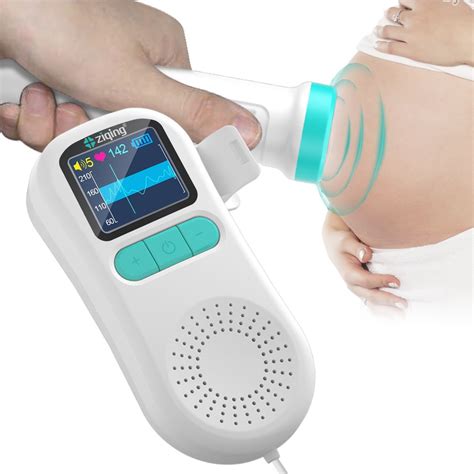 CTG-apparaat dat hartslag baby monitort