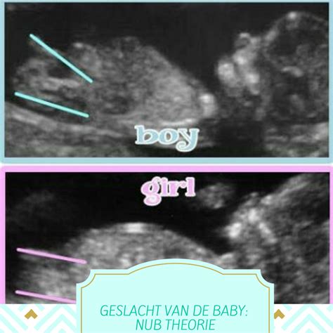 Voorbeelden van echo-beelden waarop het geslacht van de baby te zien is