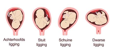 Een echo van de baarmoeder, waarop de ligging van de placenta wordt beoordeeld.