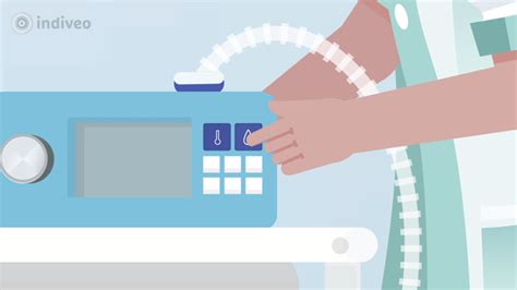 Schema van verschillende methoden voor ademhalingsondersteuning bij pasgeborenen, zoals CPAP, neusbril en beademing.