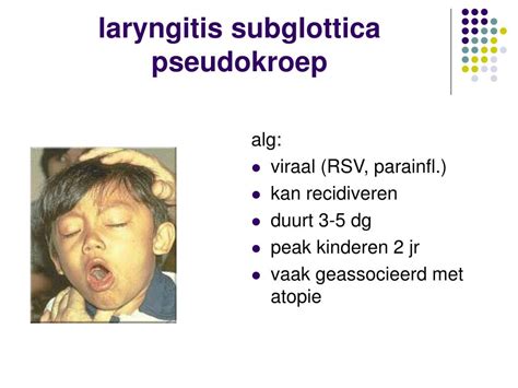 Illustratie van een kind met pseudokroep, met nadruk op de ademhalingsproblemen.