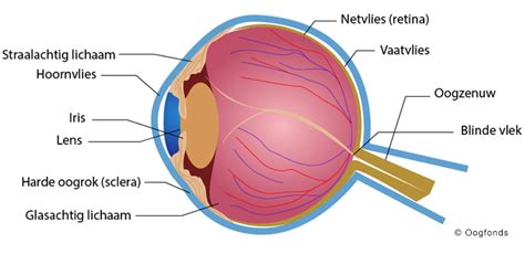 Afbeelding van een oog met een coloboom, die een gespleten iris of netvlies toont.