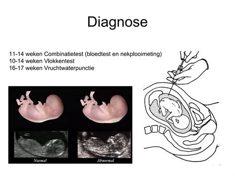 Diagram dat de vaginale en abdominale vlokkentest vergelijkt