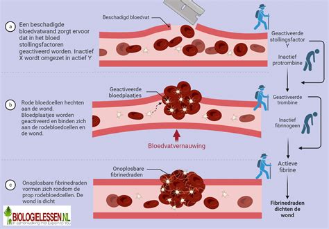 Infographic die het proces van bloedstolling met bloedplaatjes uitlegt