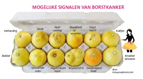 Illustratie die verschillende veranderingen aan de borst toont die op borstkanker kunnen duiden (knobbeltje, tepelveranderingen, huidveranderingen).