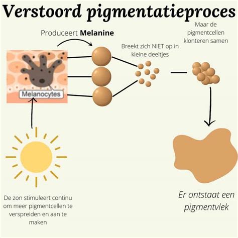 Illustratie van de huidlagen en de productie van melanine door melanocyten.
