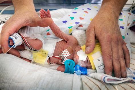 Een ouder die huid-op-huidcontact heeft met een prematuur geboren baby