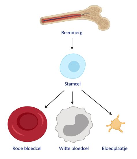 Diagram dat het proces van bloedaanmaak in het beenmerg illustreert, met een vergelijking tussen normaal beenmerg en beenmerg bij acute leukemie.