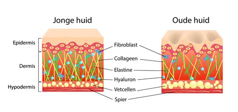 Vergelijking van huid met veel en weinig collageen en elastine