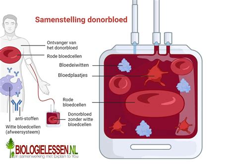 Contrast tussen een bleke (donor) en een rode (ontvanger) baby bij TAPS
