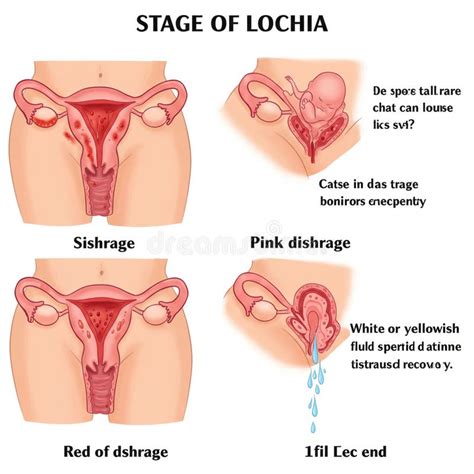 illustratie van de verschillende stadia van lochia na de bevalling