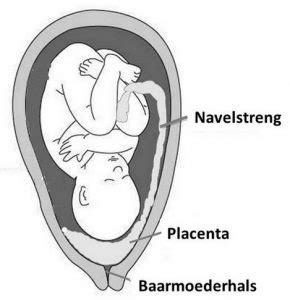 Illustratie die de verschillende posities van een voorliggende placenta ten opzichte van de baarmoedermond toont.