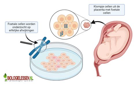 schematische weergave van de verschillende prenatale testen (combinatietest, NIPT, vlokkentest, vruchtwaterpunctie) en hun risico's/nauwkeurigheid