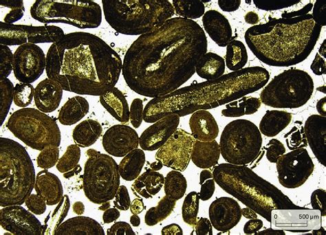 Microscopische opname van bewegende zaadcellen, verkregen na een PESA-procedure.