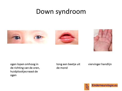 Illustratie van een familie met een kind met het syndroom van Down, die de diversiteit van het leven symboliseert.