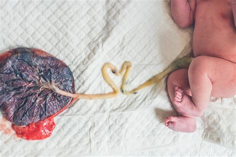 Illustratie van het correct afbinden en doorknippen van de navelstreng bij een pup.