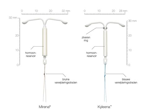 Vergelijkende infographic van Mirena en Kyleena spiraaltjes