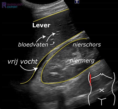 Schematische weergave van een echografie bij een drachtige hond, waarbij de foetussen zichtbaar zijn