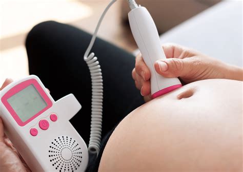 Illustratie van een CTG-apparaat dat de hartslag van de baby monitort.