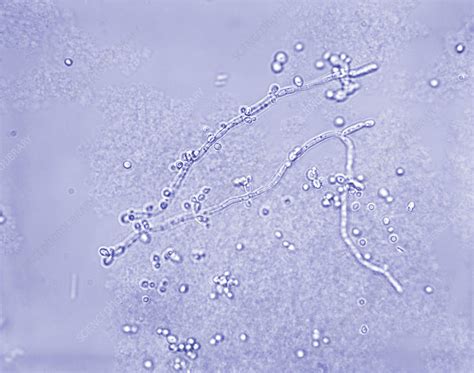 Microscopische weergave van Candida albicans