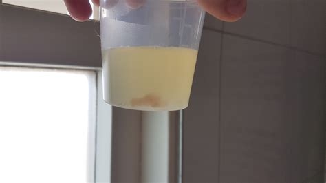 Vruchtwater: helder met eventuele witte vlokjes