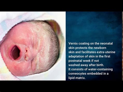 illustratie van babyhuid met vernix caseosa